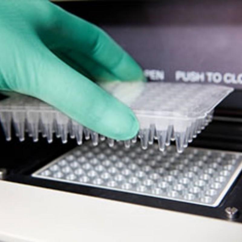人细小病毒B19(HPV B19试剂盒 荧光-PCR法)