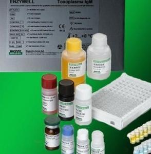 人分泌型免疫球蛋白G(SIgG)Elisa試劑盒