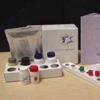 风疹病毒IgM检测试剂盒 产品图片