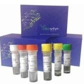 肠道病毒通用型荧光定量PCR试剂盒 产品图片