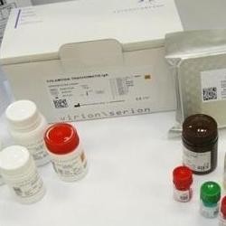 白喉IgG检测试剂盒 产品图片
