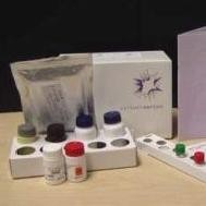 乙脑病毒IgM抗体诊断试剂盒 产品图片