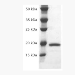 Abbkine PRP1021 重組人源IL-1α蛋白 優(yōu)勢