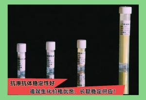 高尔基体膜蛋白GP73（GOLM1）