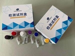 人胞浆免疫球蛋白 CIg ELISA试剂盒 产品图片