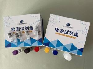 人β葡糖苷酶 β-glucosidase ELISA试剂盒 产品图片