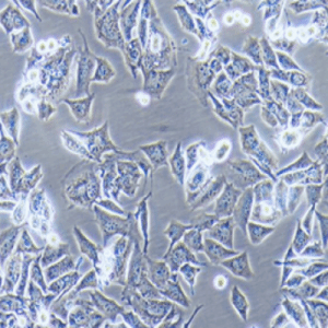 CCC-HPF-1,人胚肺二倍体细胞