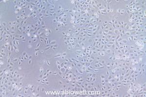 HBE135-E6E7 (人支qi guan上皮细胞) 产品图片