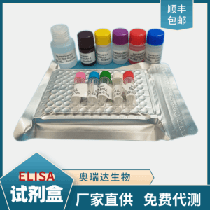 人抗核糖核蛋白抗体（RNP-Ab）检测试剂盒 产品图片