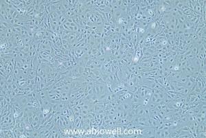 大鼠胰岛细胞瘤细胞 产品图片