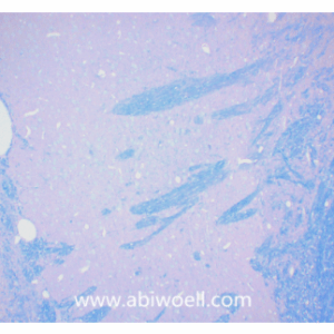 Luxol Fast Blue髓鞘染色液