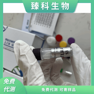 小鼠γ干扰素(IFN-γ）elisa试剂盒 产品图片