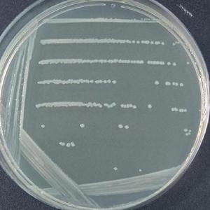 肺-炎克雷伯氏菌肺-炎亚种Klebsiella pneumoniae ss pneumoniae