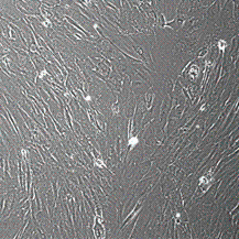 人卵巢浆液性癌相关成纤维细胞