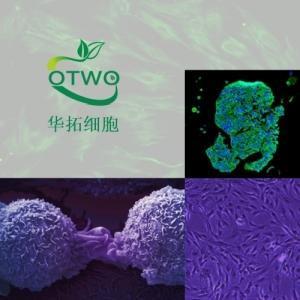 SW480[SW-480](结-肠腺-癌细胞)